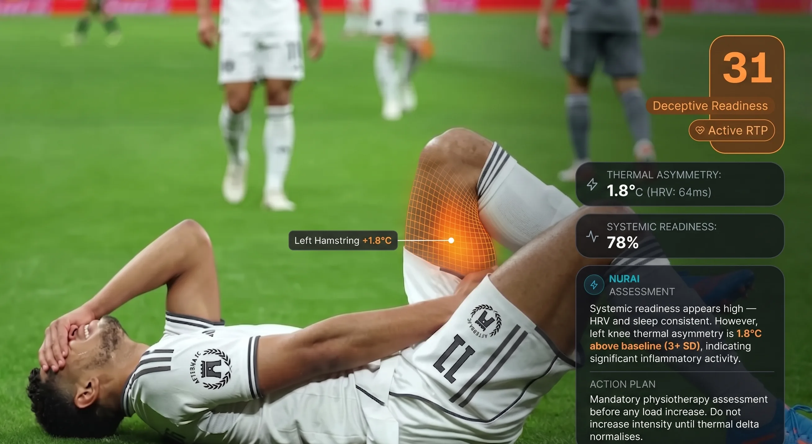 Injury Prevention — thermal asymmetry flagged
