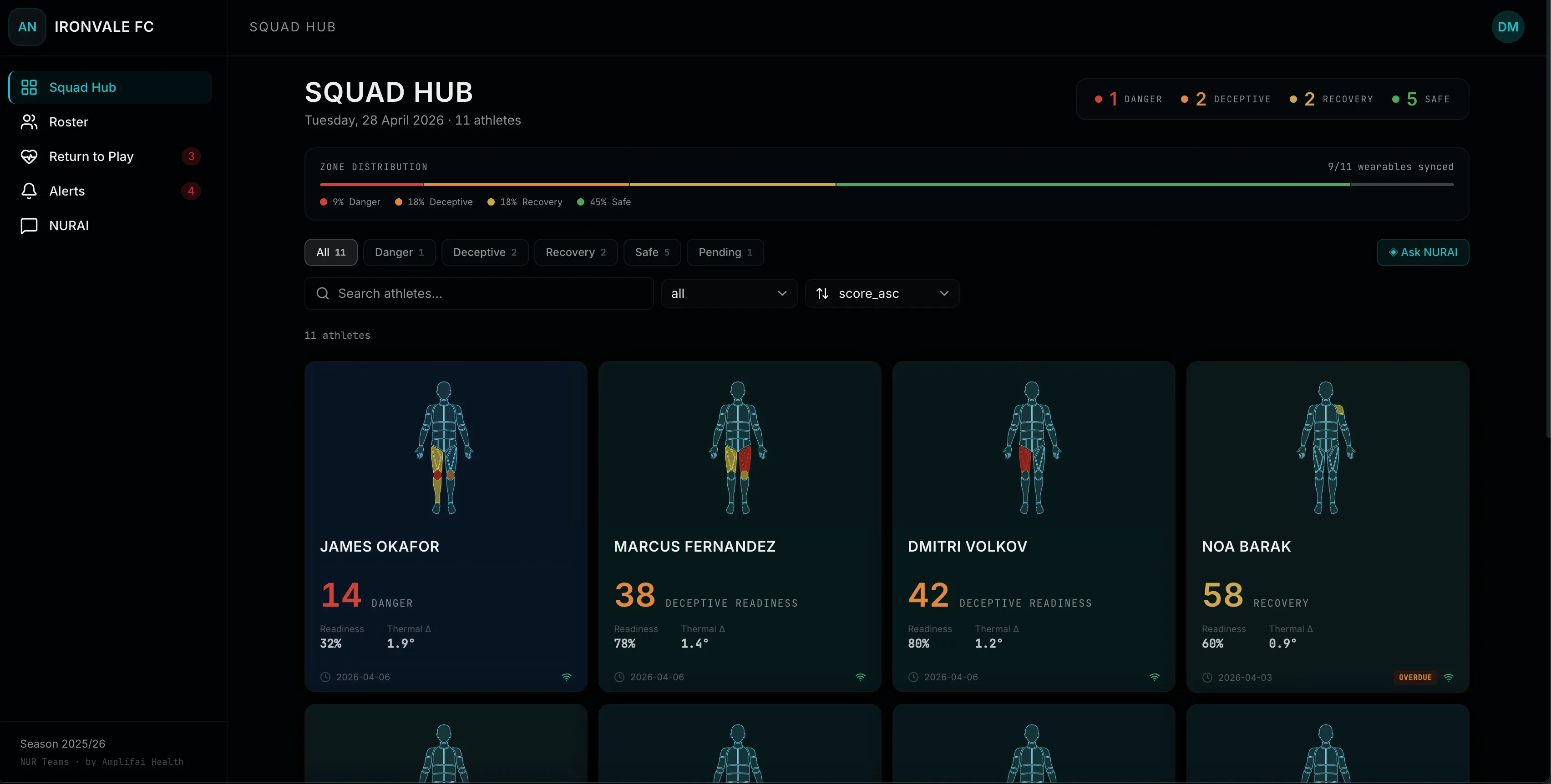 Workload management — squad hub daily view